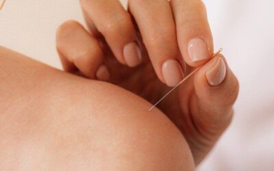 Acupunctuur bij menopauze